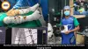 Mumbai Trauma Team Performs Complex Limb-Saving Surgery Using Advanced Portable Imaging System