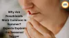 Why Are Nosebleeds More Common in Summer? Experts Explain the Seasonal Trigger