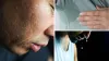 Why Do Some People Sweat Excessively? (Hyperhidrosis Explained)