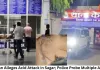 Woman Alleges Acid Attack in Sagar; Police Probe Multiple Angles