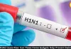 Delhi H1N1 Cases Rise: Home Gadgets for Swine Flu Prevention