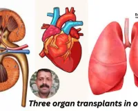 1st ever lung transplant in the country