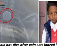 Tragic incident in Korba: 8-year-old boy dies after coin gets lodged in chest