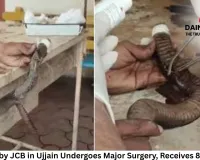 Cobra Undergoes Life-Saving Surgery in Ujjain After Bulldozer Injury; Doctors Give 80 Stitches