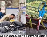 Gwalior Woman Mutilated in Domestic Assault; Five-Year-Old Daughter Witnesses Attack