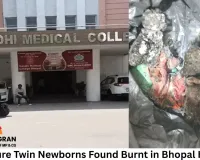Premature Twin Newborns Found Burnt in Bhopal Hospital; CCTV Footage Blurry, Police to Seize DVR