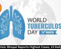 MP TB Crisis: Bhopal Reports Highest Cases, 13 Daily Deaths