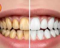 Sesame Oil Pulling: Natural Teeth Whitening for Summer