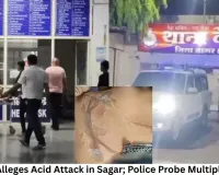Woman Alleges Acid Attack in Sagar; Police Probe Multiple Angles