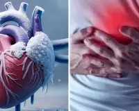 Can Heart Attack Occur Even Without High Cholesterol?