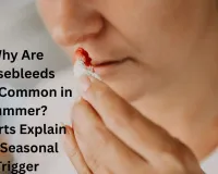 Why Are Nosebleeds More Common in Summer? Experts Explain the Seasonal Trigger