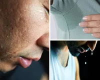 Why Do Some People Sweat Excessively? (Hyperhidrosis Explained)