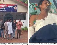 Raipur Youth Dies Seven Days After Burn Injuries, Family Alleges Friends Set Him on Fire After Luring Him to Party