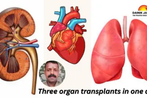 1st ever lung transplant in the country