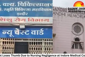 Infant Loses Thumb Due to Nursing Negligence at Indore Medical College; Action Taken Against Staff