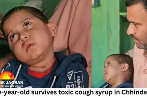 Five-year-old survives toxic cough syrup in Chhindwara, left blind and immobile after 115-day medical battle