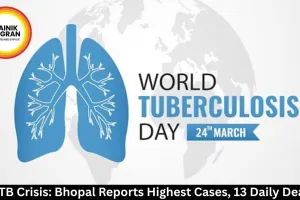 MP TB Crisis: Bhopal Reports Highest Cases, 13 Daily Deaths