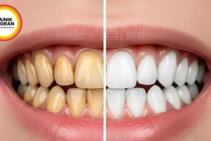 Sesame Oil Pulling: Natural Teeth Whitening for Summer