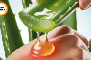 Aloe Vera for Sunburn Relief Natural Summer Hack 2026