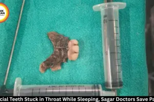 Artificial Teeth Stuck in Throat Removed at Sagar BMC