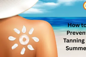 How to Prevent Tanning in Summer: Experts Share Effective Tips to Protect Skin from Sun Damage