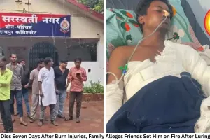 Raipur Youth Dies Seven Days After Burn Injuries, Family Alleges Friends Set Him on Fire After Luring Him to Party